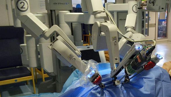 Pros of Robotic Surgery