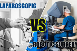 Laparoscopic Vs Robotic Surgery in Urology