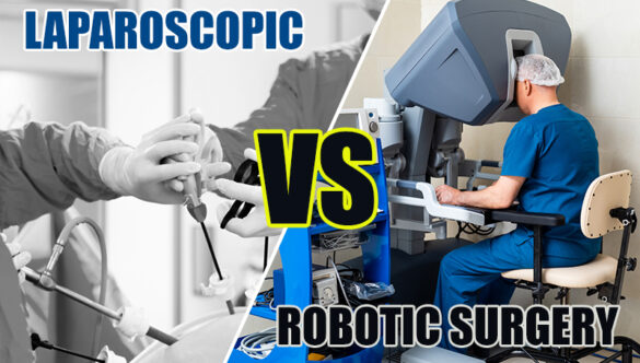 Laparoscopic Vs Robotic Surgery in Urology