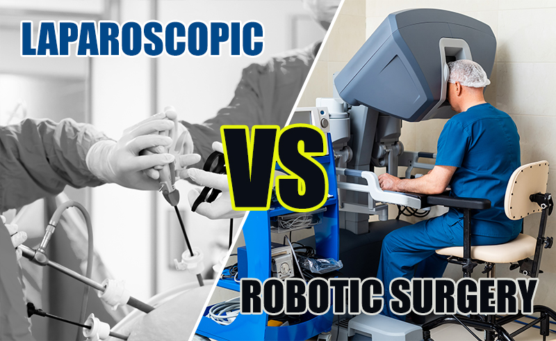 Laparoscopic Vs Robotic Surgery in Urology